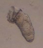 Wurm2_Gyrodactylus.jpg