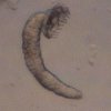 Wurm1_Gyrodactylus.jpg