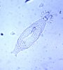 gyrodactylus%20www_cnr_vt_edu.jpg
