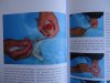 Kosmetische Chirurgie 004.JPG