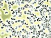 Micrococcus.jpg