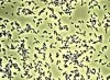 Pseudomonas.jpg